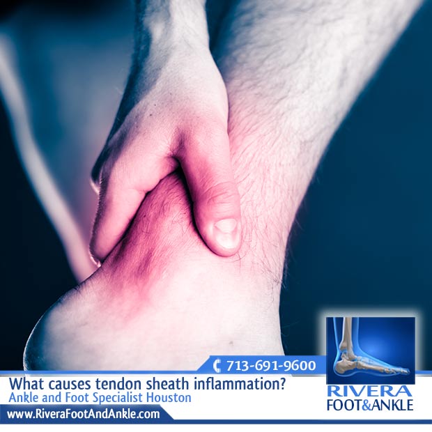 Rivera Foot And Ankle What Causes Tendon Sheath Inflammation