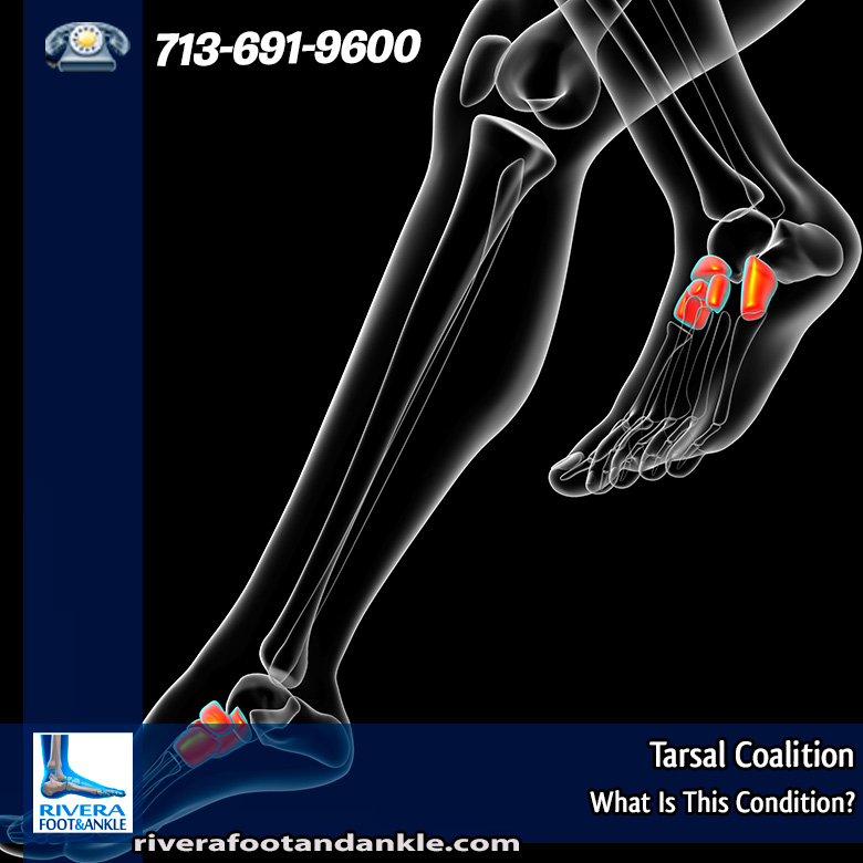 19-Food-and-Ankle-Surgeon-Houston