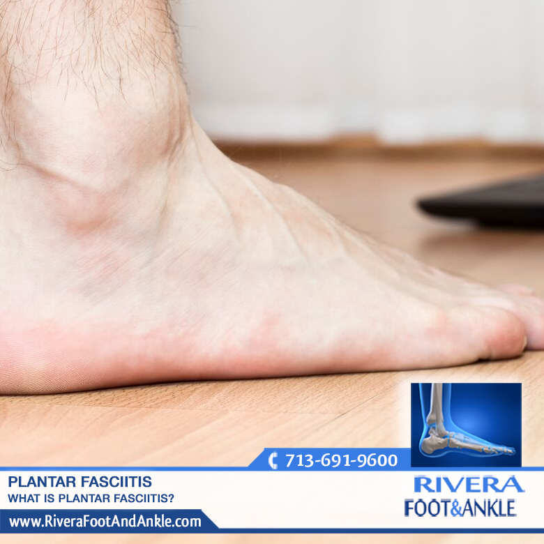 Rivera Foot And Ankle Plantar Fasciitis