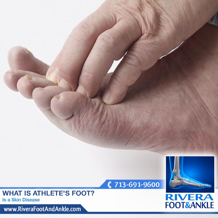 191016 Houston Ankle and Foot Specialist