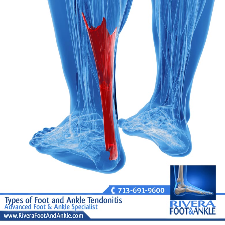 18 Advanced Foot & Ankle Specialist