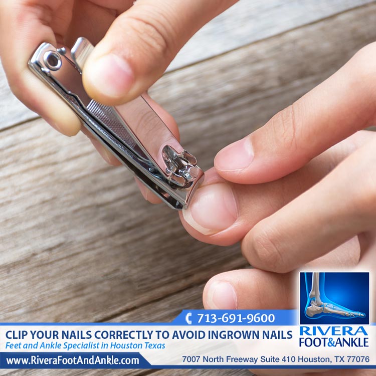 270618 toenails Specialist in Houston Texas