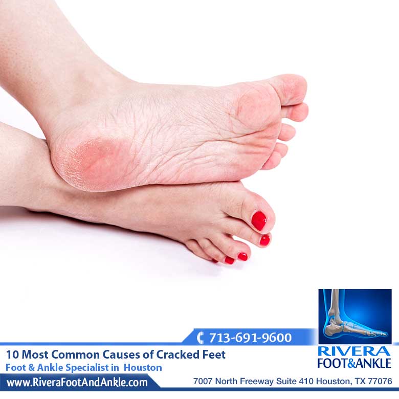 16 Foot Ankle Specialist in Houston