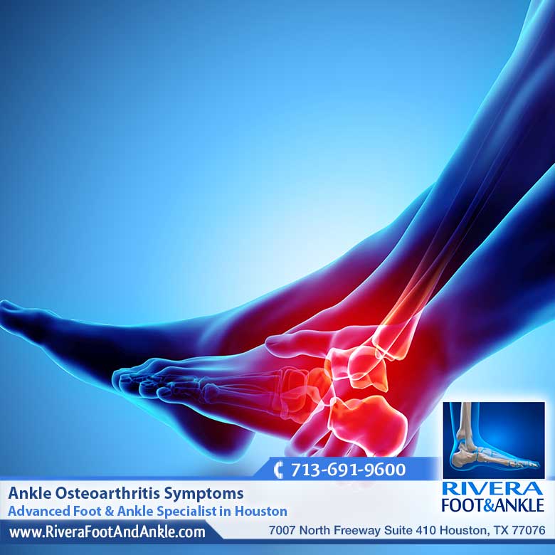 18 Advanced Foot & Ankle Specialist in Houston