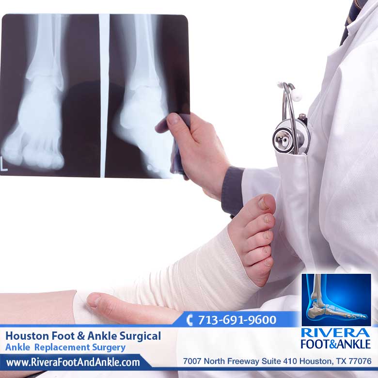 28 Houston Foot Ankle Surgical