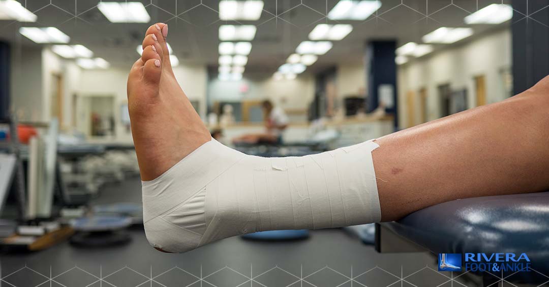 06 Ankle Disorders Diagnosis and Treatment