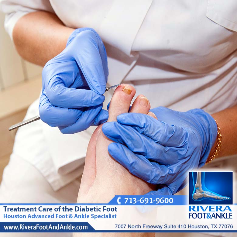 08 Houston Advanced Foot Ankle Specialist