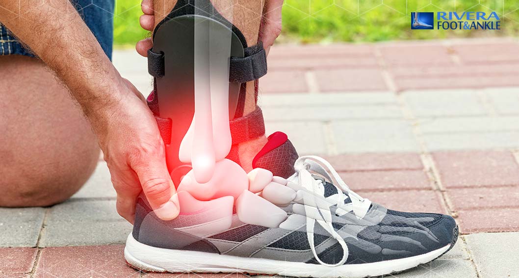 16 Chronic Ankle Instability