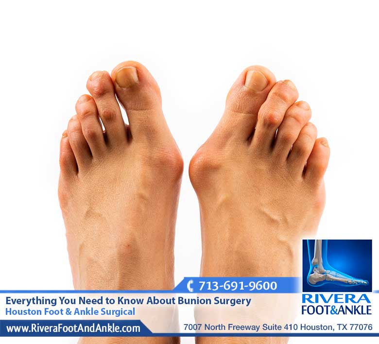 22 Houston Foot Ankle Surgical