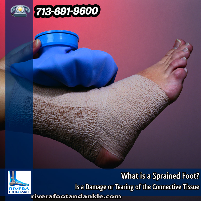 27-what-is-a-sprained-foot