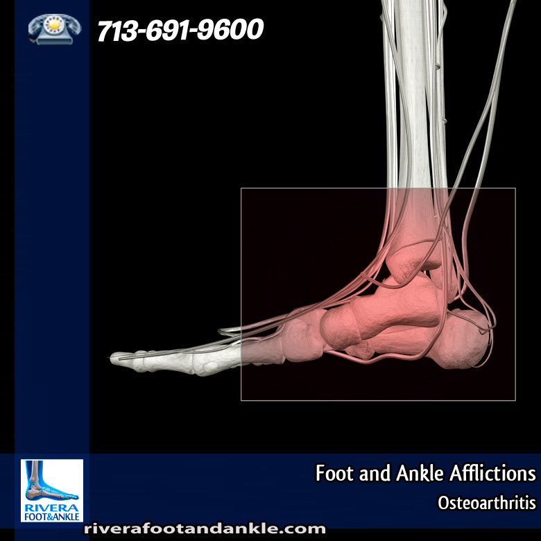 23-foot-and-ankle-afflictions