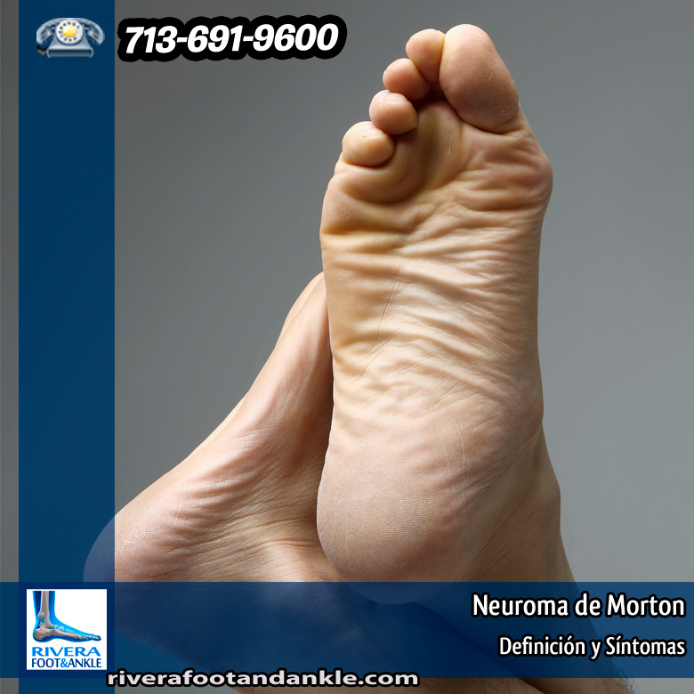 10-neuroma-de-morton